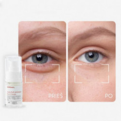 Skinlovers 4’E Anti-Puff & Wrinkle Eye Cream Intensīvi atjaunojošs krēms zonai zem acīm 15 ml