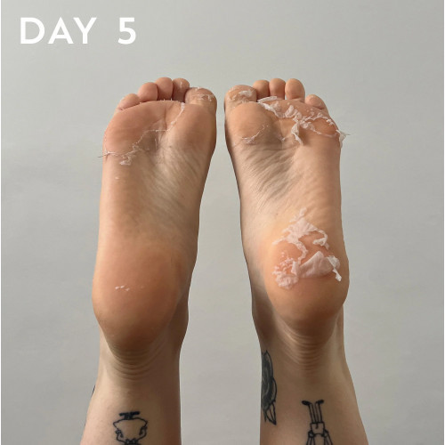 Maskology Foot Peel Professional Foot Treatment Nolobāma pēdu maska - zeķes 1 pair