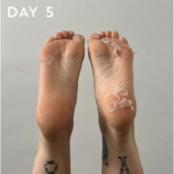 Maskology Foot Peel Professional Foot Treatment Nolobāma pēdu maska - zeķes 1 pair