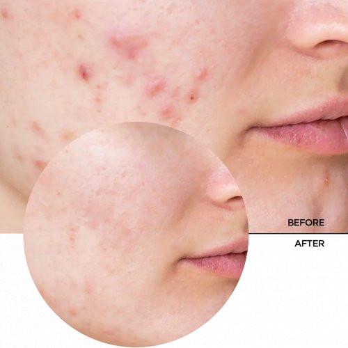 Revox B77 Just Niacinamide 10% Daily Moisturiser Mitrinošs serums sejai un kaklam 30ml