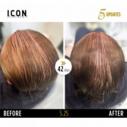 I.C.O.N. 5.25 Hair Growth Replenisher Serums pret matu izkrišanu 100ml