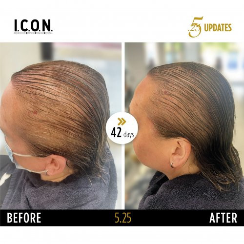 I.C.O.N. 5.25 Hair Growth Replenisher Serums pret matu izkrišanu 100ml