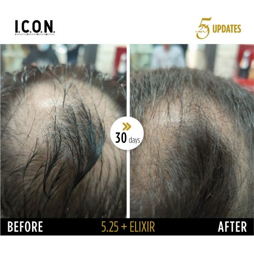 I.C.O.N. 5.25 Hair Growth Replenisher Serums pret matu izkrišanu 100ml