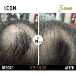 I.C.O.N. 5.25 Hair Growth Replenisher Serums pret matu izkrišanu 100ml