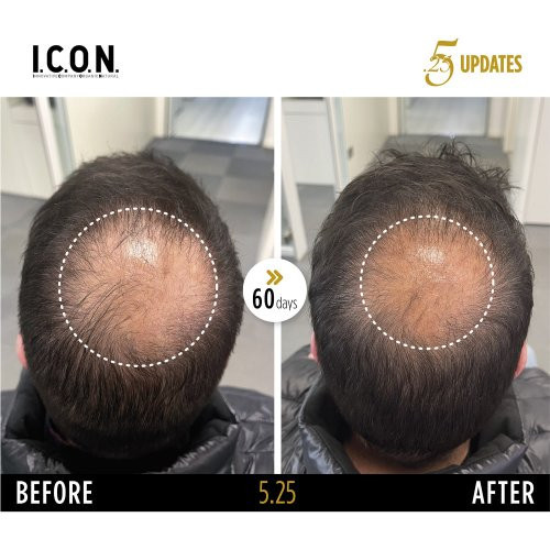 I.C.O.N. 5.25 Hair Growth Replenisher Serums pret matu izkrišanu 100ml