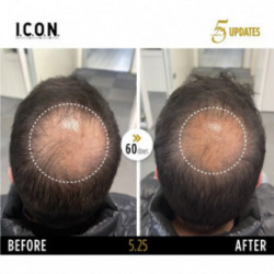 I.C.O.N. 5.25 Hair Growth Replenisher Serums pret matu izkrišanu 100ml
