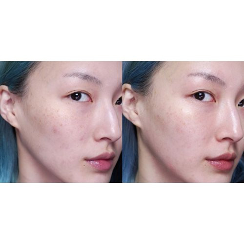 Holika Holika Mechnikov's Probiotics Formula Renewing Serum Seruma komplekts ādas jaunībai Kit